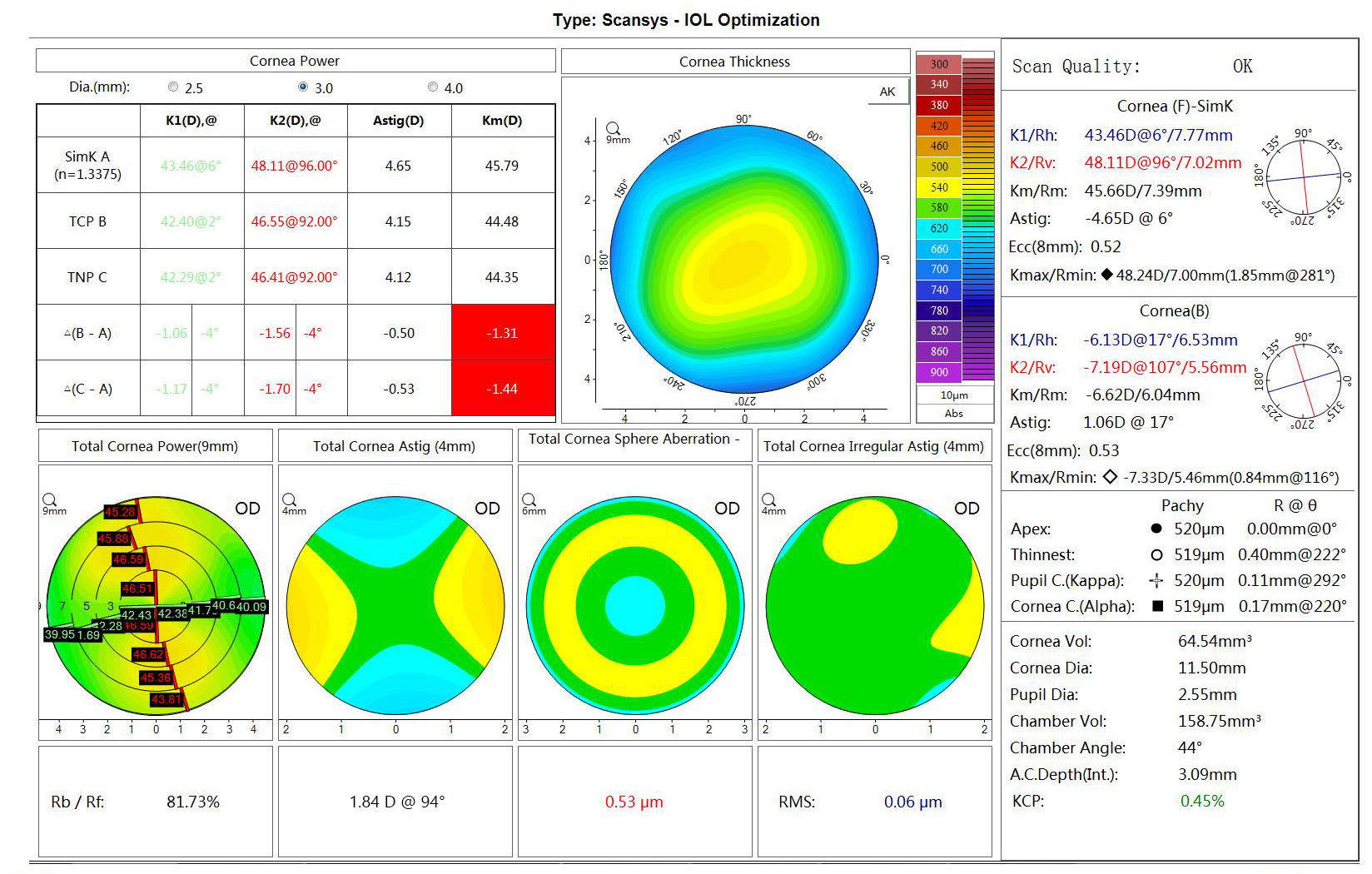 4 Steps of IOL Optimization