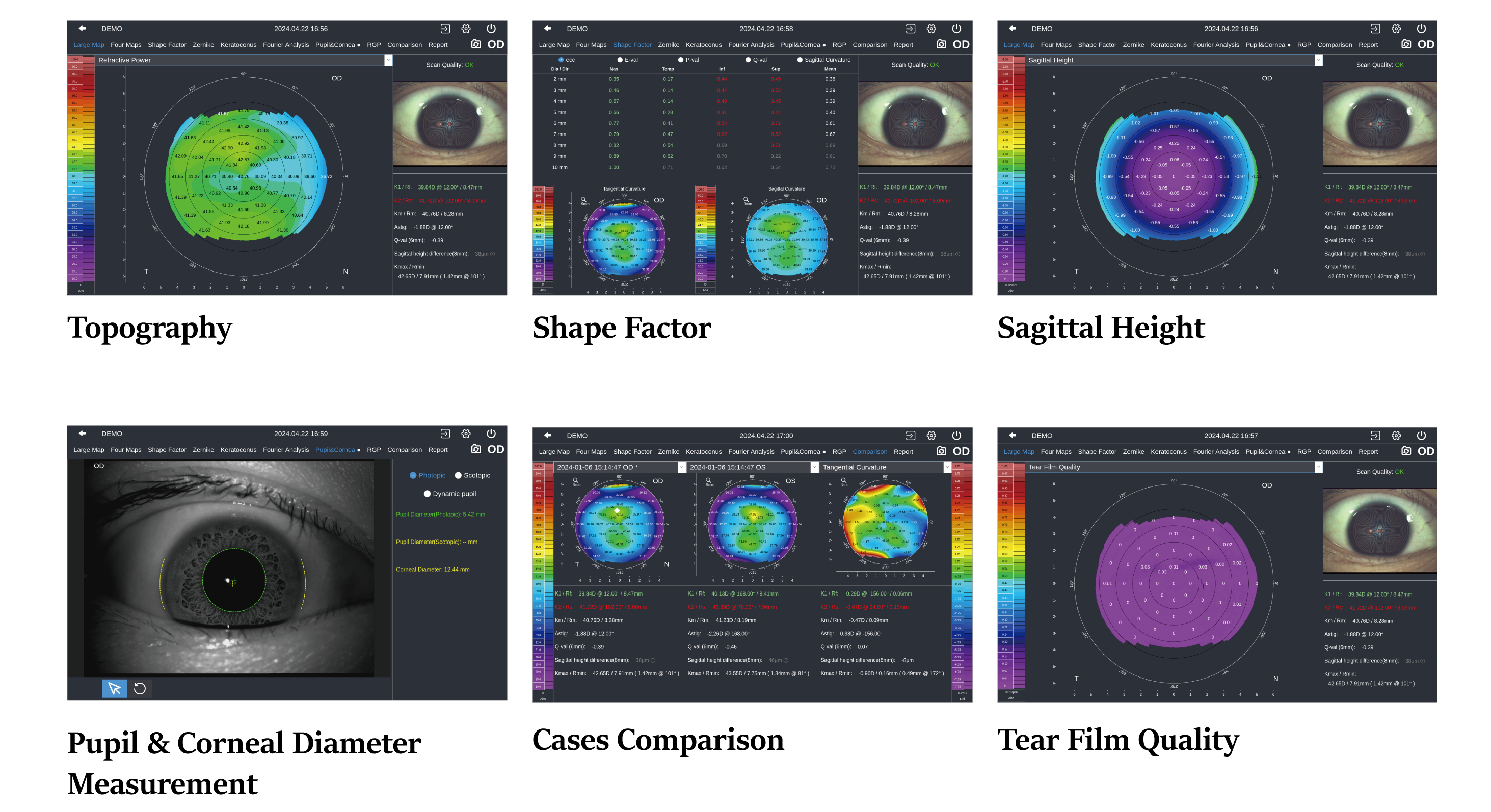 Corneal Topographer DEA520_20240718-13.jpg